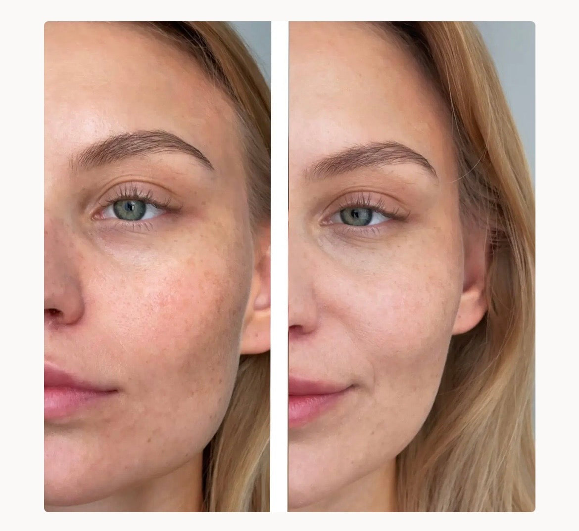 Сироватка з вітаміном С