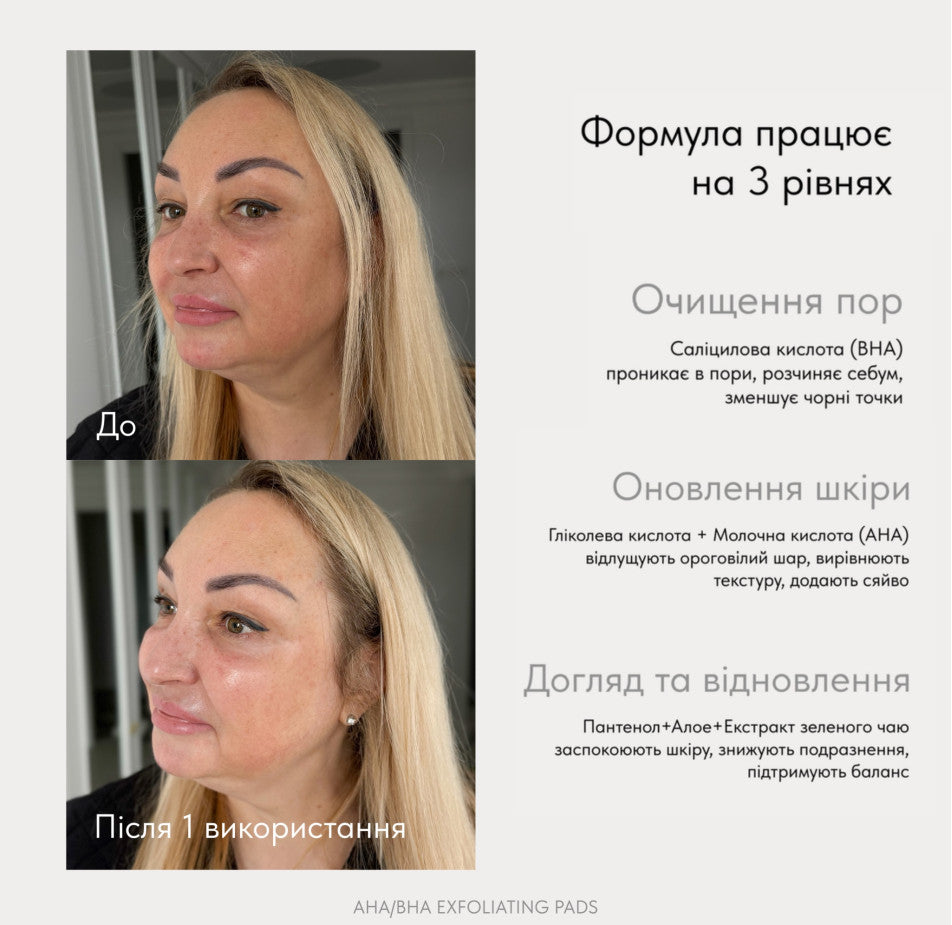 МУЛЬТИКИСЛОТНІ
ПІЛІНГ-ПЕДИ ДЛЯ
ОБЛИЧЧЯ АНА/ВНА
EXFOLIATING PADS