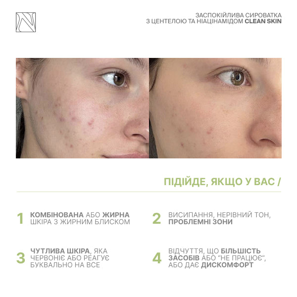 ЗАСПОКІЙЛИВА СИРОВАТКА З ЦЕНТЕЛОЮ ТА НІАЦИНАМІДОМ CLEAN SKIN SERUM