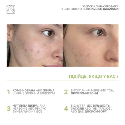 ЗАСПОКІЙЛИВА СИРОВАТКА З ЦЕНТЕЛОЮ ТА НІАЦИНАМІДОМ CLEAN SKIN SERUM