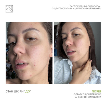 ЗАСПОКІЙЛИВА СИРОВАТКА З ЦЕНТЕЛОЮ ТА НІАЦИНАМІДОМ CLEAN SKIN SERUM