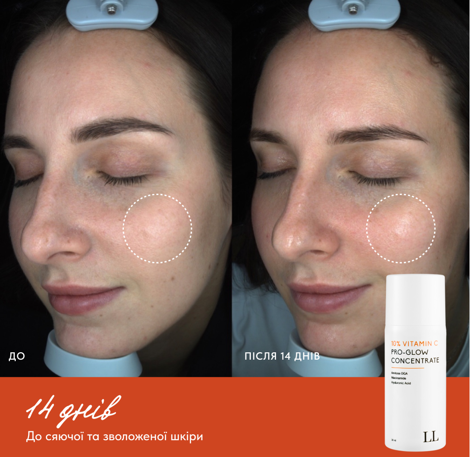 Сироватка з 10% вітаміном С