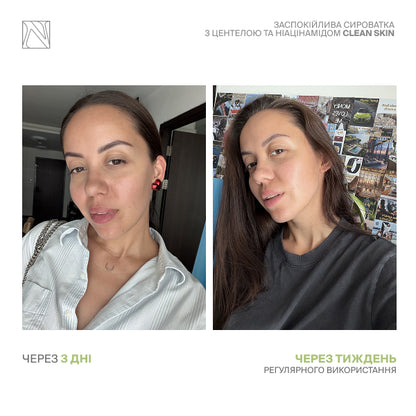 ЗАСПОКІЙЛИВА СИРОВАТКА З ЦЕНТЕЛОЮ ТА НІАЦИНАМІДОМ CLEAN SKIN SERUM